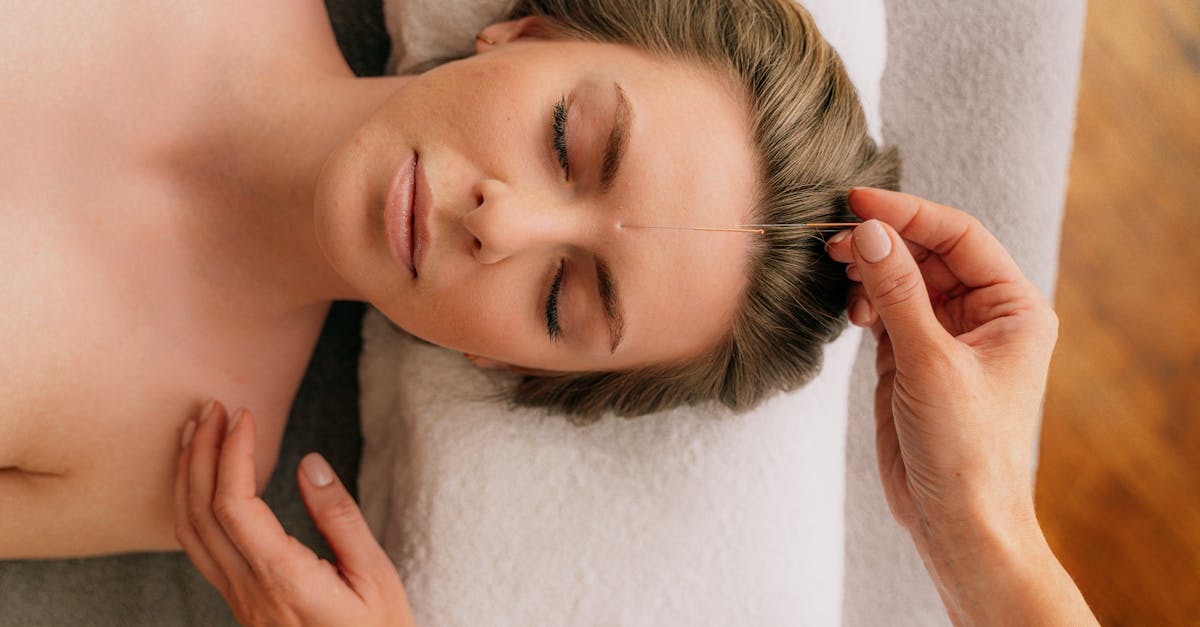 Acupuncture Treatment Outcomes for Migraines and Headaches