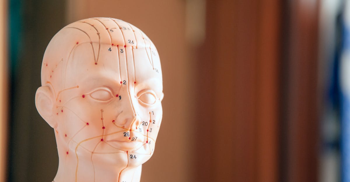 Assessing Pain Relief Outcomes from Acupuncture in Brisbane