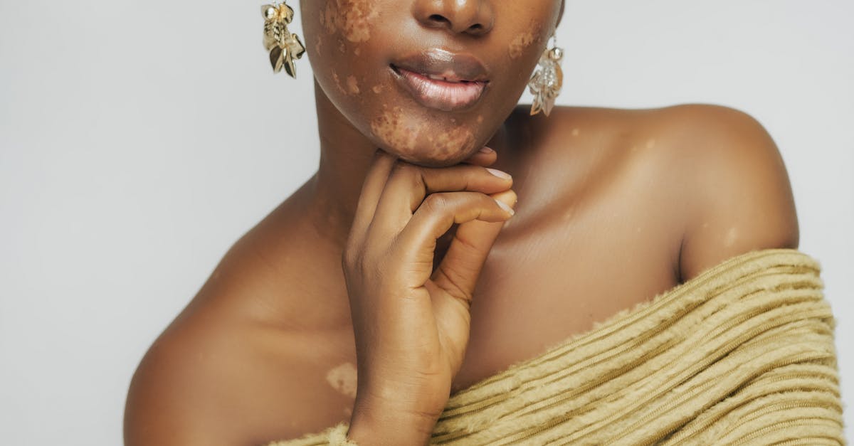 Best Workshops and Seminars for Acupuncture Professionals