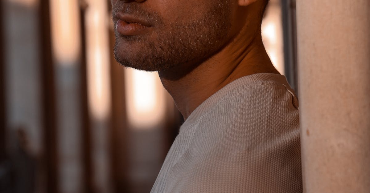 Migraines No More: Real Success Stories from Acupuncture Treatments