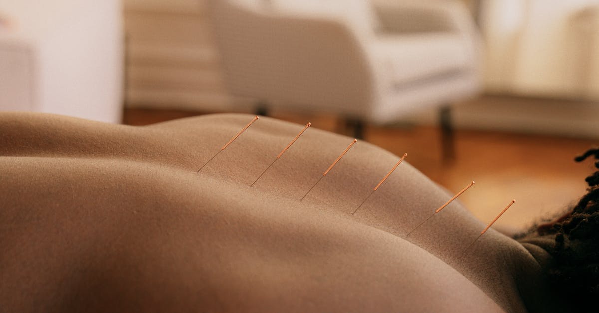 Navigating Online Learning Opportunities for Acupuncturists