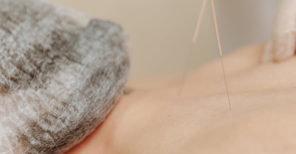 The Benefits of Pediatric Acupuncture for Children's Health