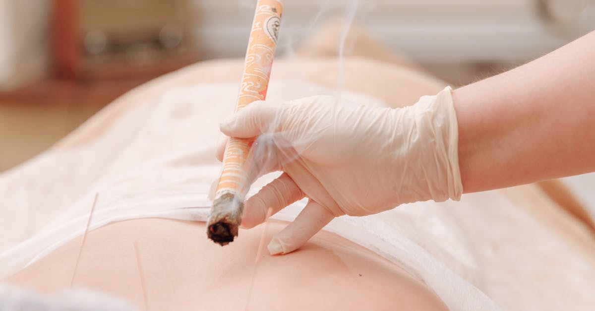 The Role of Professional Associations in Acupuncture Certification